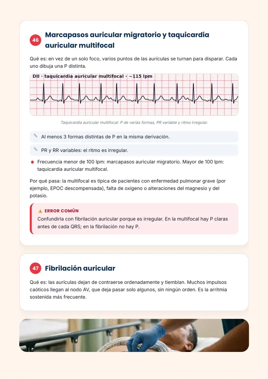 Página: fibrilación auricular