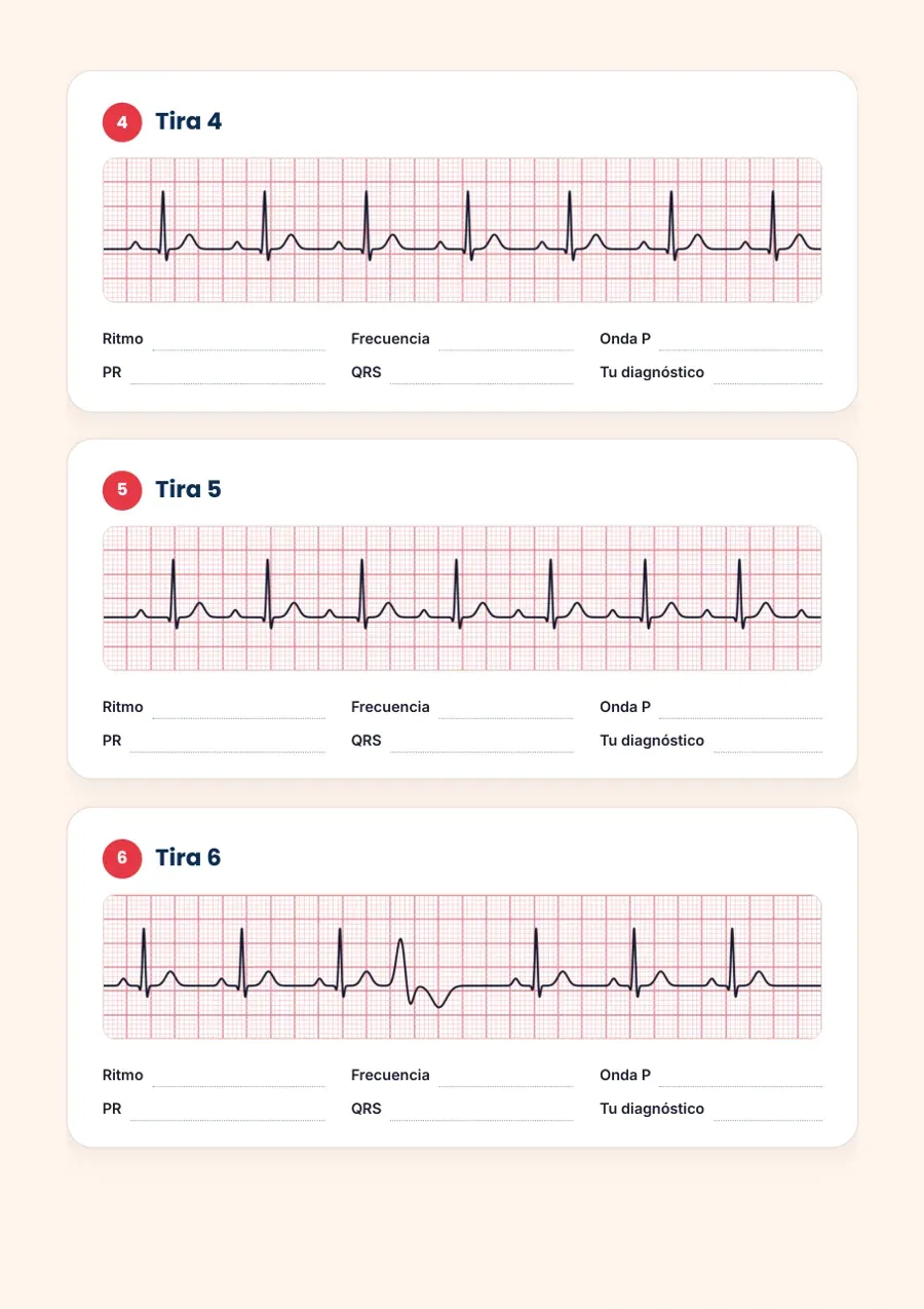 100 ECG para practicar